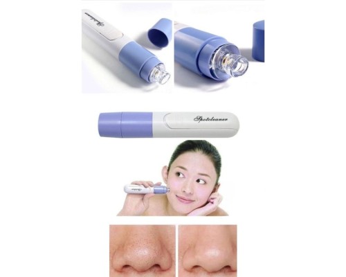 Pore Cleaner Vakumlu Yüz Temizleme Siyah Nokta Temizleme Cihazı Pore Cleaner Vakumlu Yüz Temizleme Siyah Nokta Temizleme Cihazı